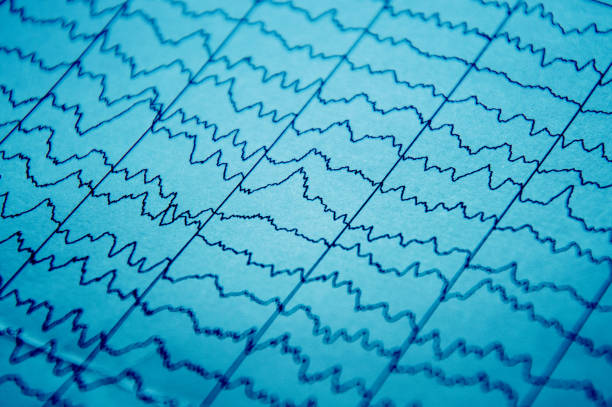 eeg electro physiological monitoring metod. electrical activity of the brain. - pulse trace computer monitor eeg equipment imagens e fotografias de stock