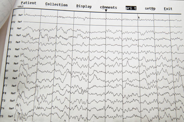 metodo di monitoraggio elettrofisi fisiologico eg. onda eeg nel cervello umano, eeg del bambino, problemi nell'attività elettrica del cervello - pulse trace computer monitor eeg equipment foto e immagini stock