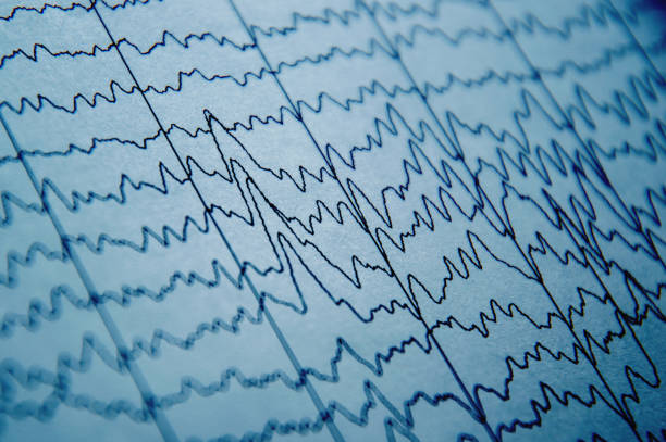 onda eeg nel cervello umano, modelli di onde cerebrali sull'elettroencefalogramma, problemi nell'attività elettrica del cervello - pulse trace computer monitor eeg equipment foto e immagini stock