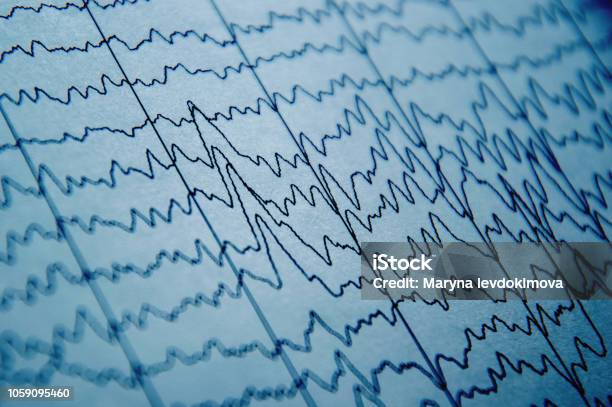 Eeg Wave In Human Brain Brain Wave Patterns On Electroencephalogram Problems In The Electrical Activity Of The Brain Stock Photo - Download Image Now