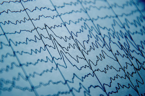 eeg wave in human brain, brain wave patterns on electroencephalogram, problems in the electrical activity of the brain - pulse trace computer monitor eeg equipment imagens e fotografias de stock