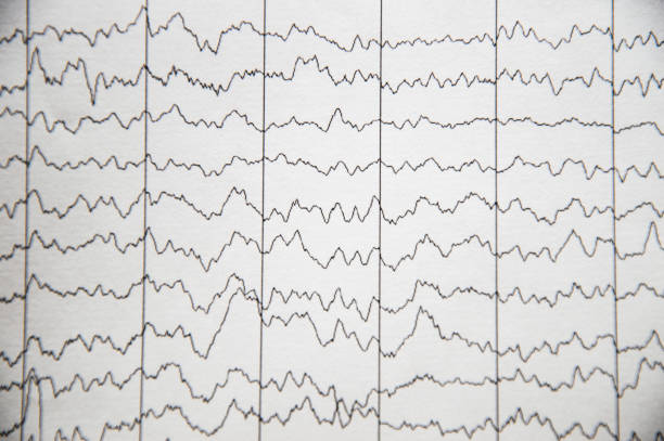 electrical activity of the brain, eeg of pediatric patients with immaturity of the cerebral cortex - pulse trace computer monitor eeg equipment imagens e fotografias de stock