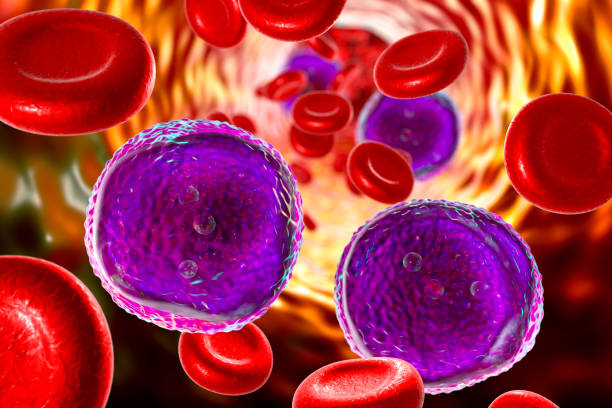 急性リンパ性白血病 - hematology ストックフォトと画像