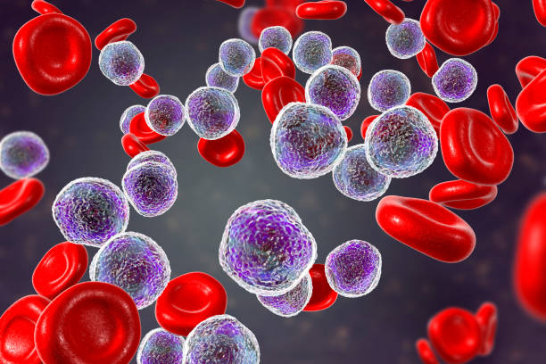 leucemia linfoblastica acuta - blood cell foto e immagini stock