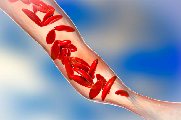 anemia de células falciformes - healthcare and medicine human cardiovascular system anatomy human blood vessel fotografías e imágenes de stock