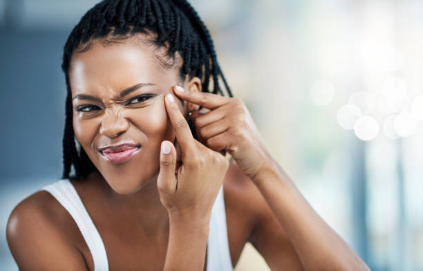 istock Ain't nobody got time for zits 1059181648