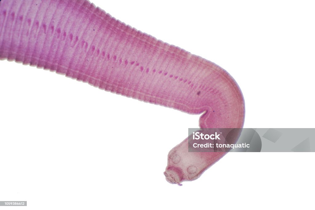 Tapeworm (Parasitic flatworm) of cattle and other grazing animals under the microscope for education. Tapeworm Stock Photo