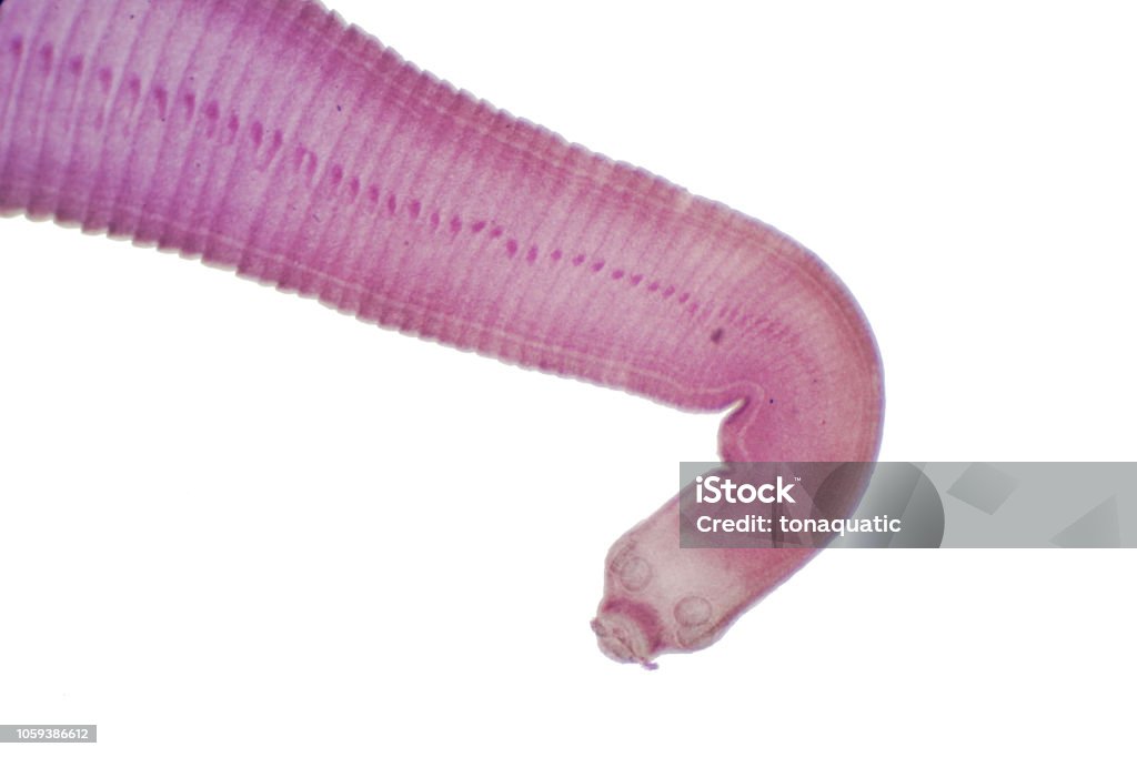 Tapeworm Of Cattle And Other Grazing Animals Under The Microscope For Education Stock Photo - Download Image Now - iStock Tapeworm Of Cattle And Other Grazing Animals Under The Microscope For Education Stock Photo - Download Image Now - iStock