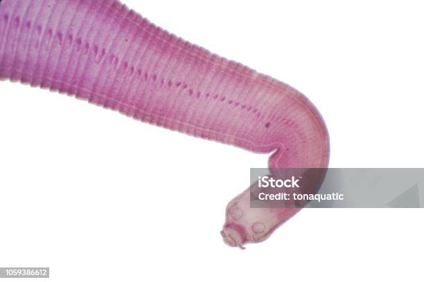 Tapeworm Of Cattle And Other Grazing Animals Under The Microscope For Education Stock Photo - Download Image Now