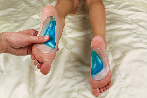 Plantillas ortopédicas para pies de los niños. Tratamiento del pie plano. photo