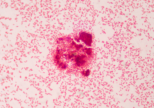 Bacteria intracellular red cells in gramstain find with microscope.