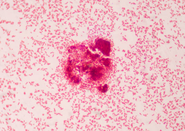 Sin Simular Destrucción Bacteria Intracellular Red Cells In Gramstain Find With Microscope Stock Photo - Download Image Now - iStock Sin Simular Destrucción Bacteria Intracellular Red Cells In Gramstain Find With Microscope Stock Photo - Download Image Now - iStock