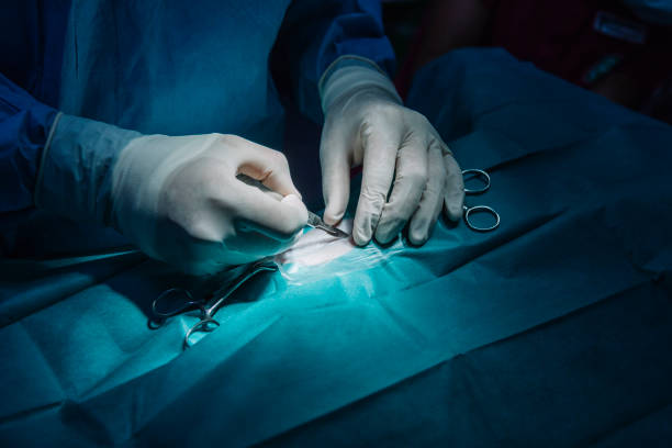 primer plano de cirujano haciendo puntadas - sewing stitches thread surgery fotografías e imágenes de stock