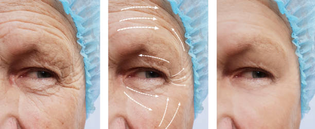 old man with wrinkles on face before and after procedures arrow old man with wrinkles on face before and after procedures arrow slow motion face stock pictures, royalty-free photos & images