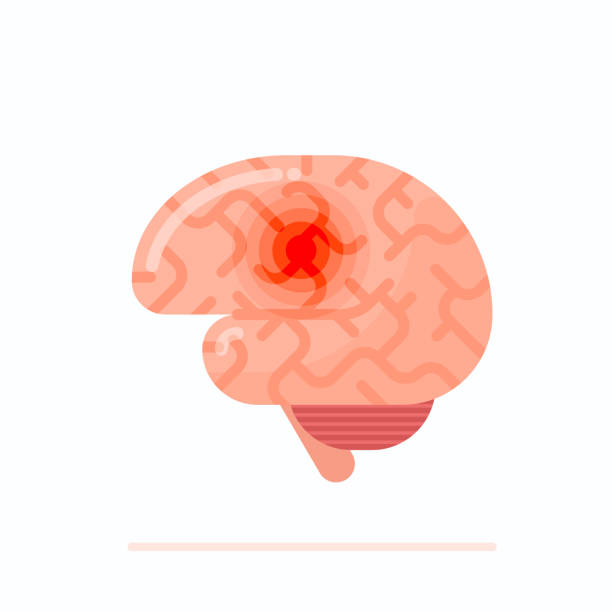 Flat Design Illustration Of Human Brain Stock Illustration - Download Image  Now - Stroke - Illness, Cartoon, Healthcare And Medicine - iStock