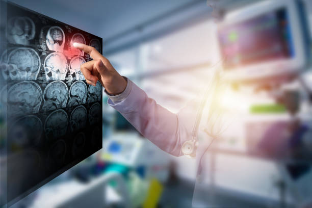 doctor touching computer screen of CT brain image in working room, illustration ECG doctor touching computer screen of CT brain image in working room, illustration ECG and light and double exposure with woman doctor critical care photos stock pictures, royalty-free photos & images