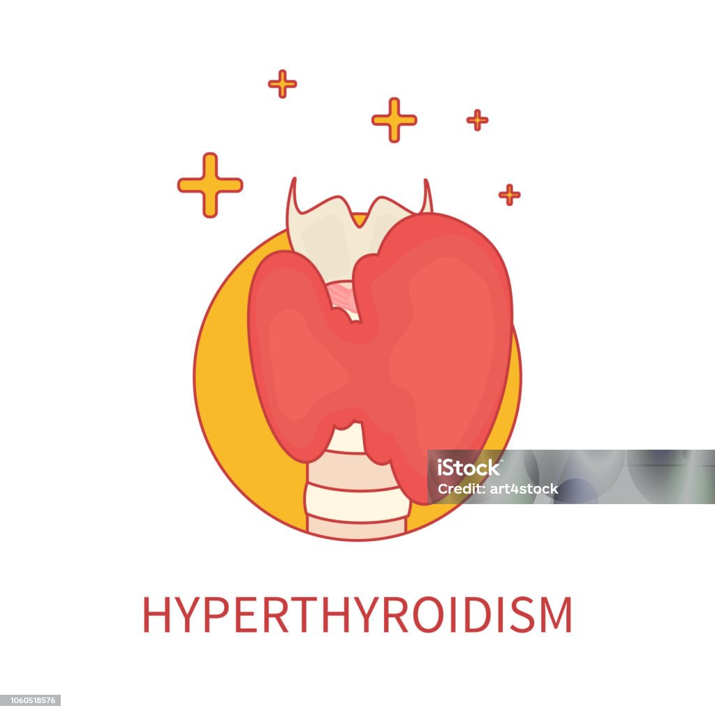 Hyperthyreose Hyperthyroid Gland Front View In Linear Stile Stock Illustration ...