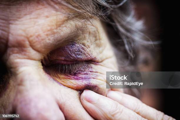 Senior Woman Touches Bruise And Winces Stock Photo - Download Image Now - Elder Abuse, Domestic Violence, Senior Adult