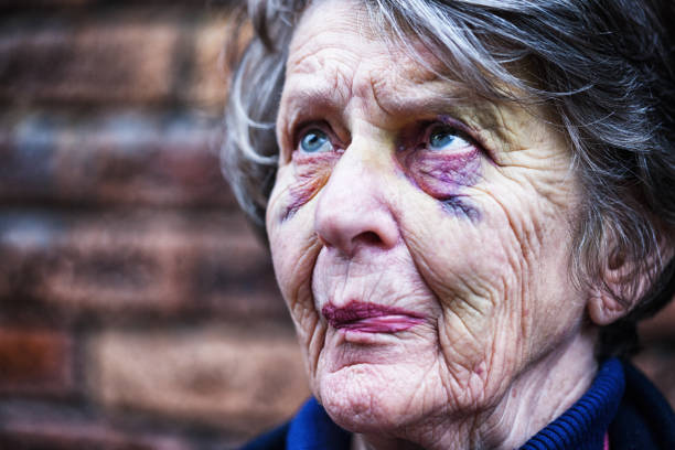 istock Sad and scared old woman with bruised face 1061199108