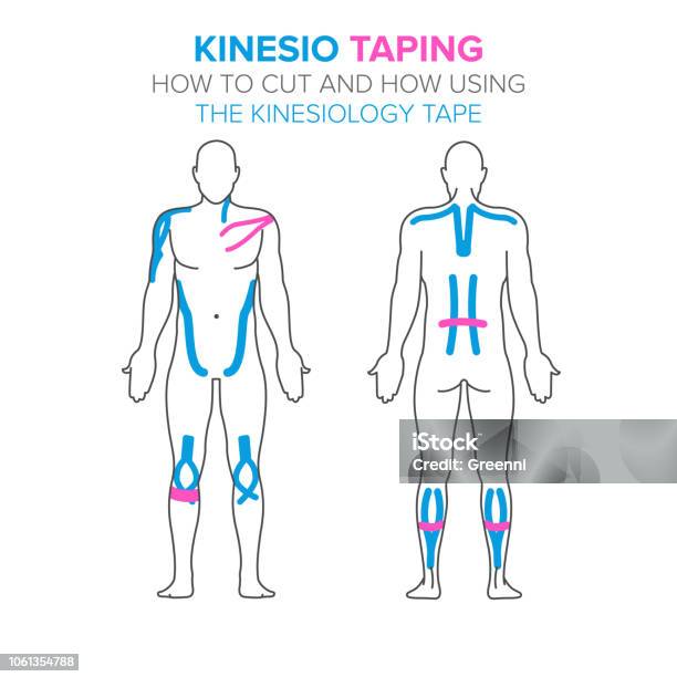 Kinesio Taping How Using And How To Cut The Kinesiology Tape Stock Illustration - Download Image Now