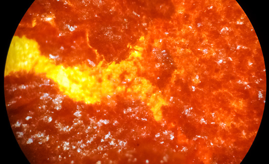 Sustancia naranja, ferroceno, bajo un microscopio photo