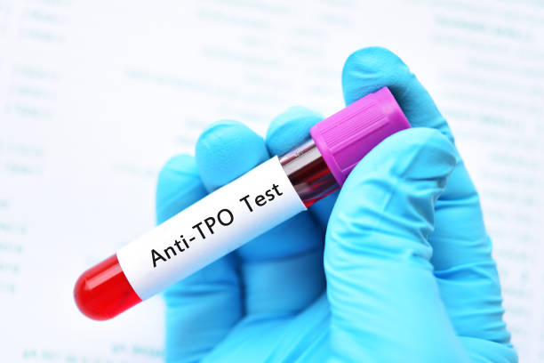 Blood sample tube for anti-TPO test Blood sample tube for anti-TPO or anti-thyroid peroxidase test, diagnosis for thyroid hormone disease autoantibody stock pictures, royalty-free photos & images
