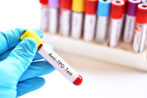 Blood sample tube for anti-TPO test Blood sample tube for anti-TPO or anti-thyroid peroxidase test, diagnosis for thyroid hormone disease autoantibody stock pictures, royalty-free photos & images