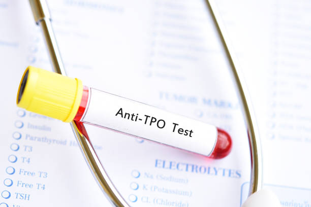 Blood sample tube for anti-TPO test Blood sample tube for anti-TPO or anti-thyroid peroxidase test, diagnosis for thyroid hormone disease autoantibody stock pictures, royalty-free photos & images