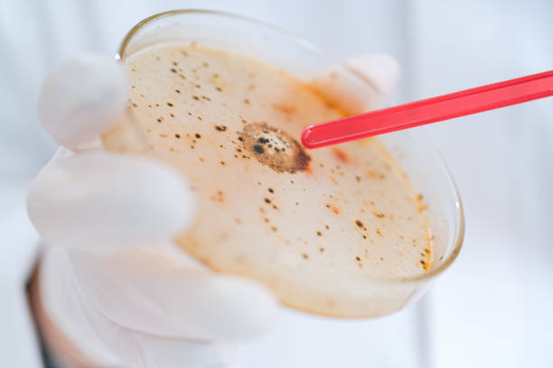 petri dish with agar and bacteria. stock photo