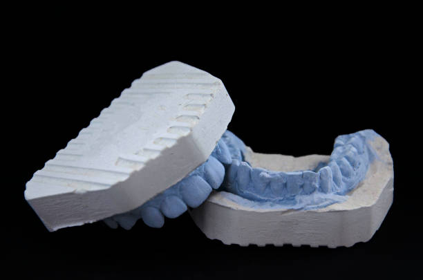 istock Orthodontic cast of human jaw. 1062107458