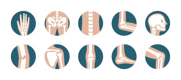 人類關節和骨骼的集合。向量膝蓋, 腿, 骨盆, 肩骨, 頭骨, 肘部, 腳和手圖示。在白色背景的矯形和骨骼符號 - 人體骨骼 幅插畫檔、美工圖案、卡通及圖標