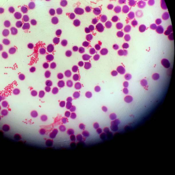 infezione batterica gram-negativa del flusso sanguigno vista attraverso il microscopio - colorazione di gram foto e immagini stock