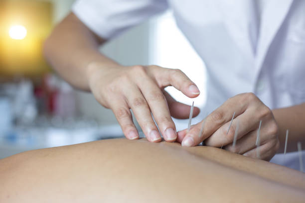 istock Traditional Chinese Medicine Treatment - Acupuncture 1063261796