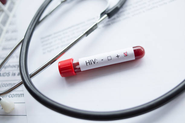 istock Close up of stethoscope and HIV test. 1063376318