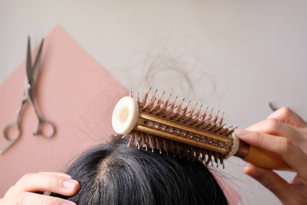 istock hair fall and lost alopecia woman problem on the comb. 1063601184