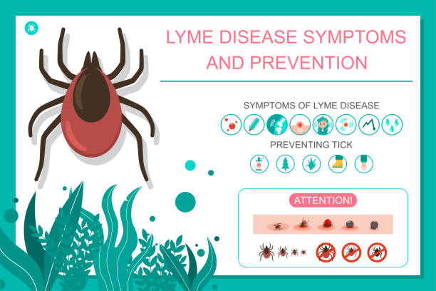 ilustrações de stock, clip art, desenhos animados e ícones de preventing tick bite and lyme disease symptoms. vector cartoon medical infographic. - lyme disease