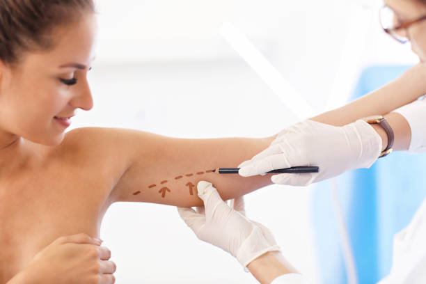 Plastic surgeon making marks on patient's body stock photo