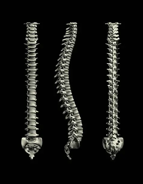 3D rendering of Human Spine. Showing three sides of the Human Spine.