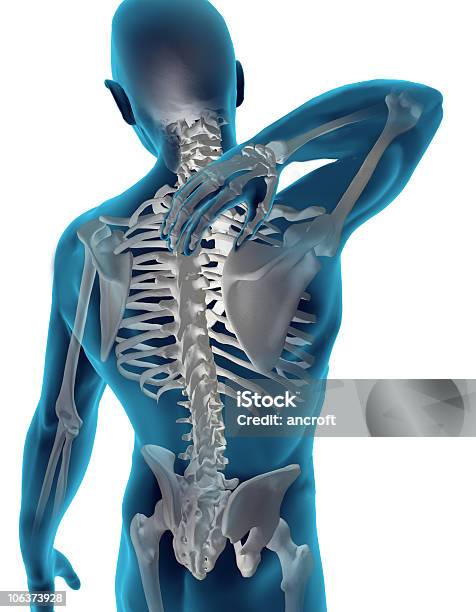 Ból Szyi Z - zdjęcia stockowe i więcej obrazów Korekta kręgosłupa - Korekta kręgosłupa, Od tyłu, Pionowy