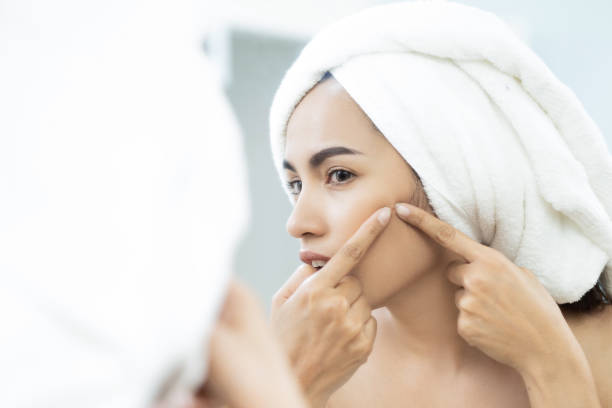 istock Asian women are squeezing acne after bathing. 1063976584