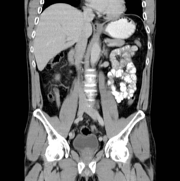 tk jamy brzusznej - stomach the human body abdomen human digestive system zdjęcia i obrazy z banku zdjęć