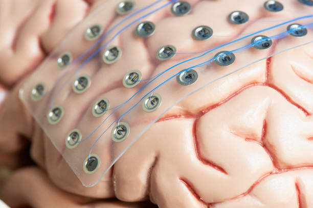 elettrodi di registrazione delle onde cerebrali sulla superficie del modello cerebrale - eeg epilepsy science electrode foto e immagini stock