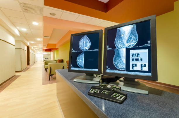 imágenes de mamografía del pecho de un paciente femenino. - cirugía fotos fotografías e imágenes de stock