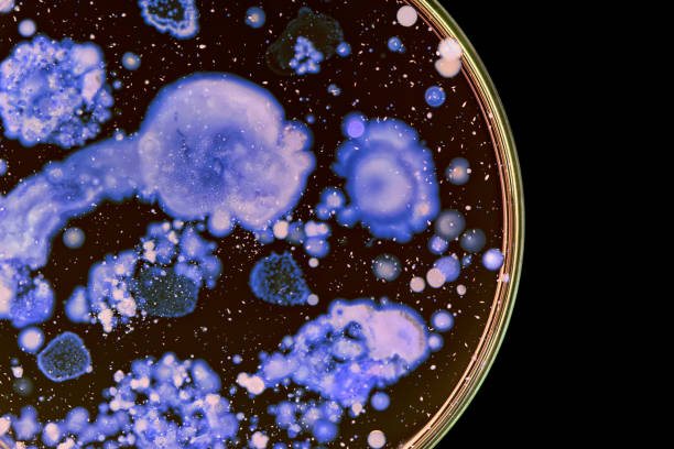 istock Bacteria colonies in a petri dish 1064613654