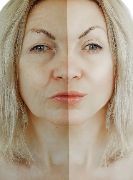 istock woman wrinkles face before and after aging concept 1064679342