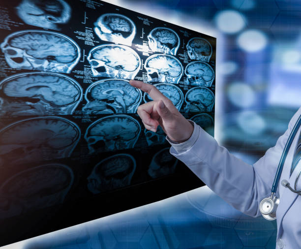 istock doctor pointing finger to CT scan 1064984534