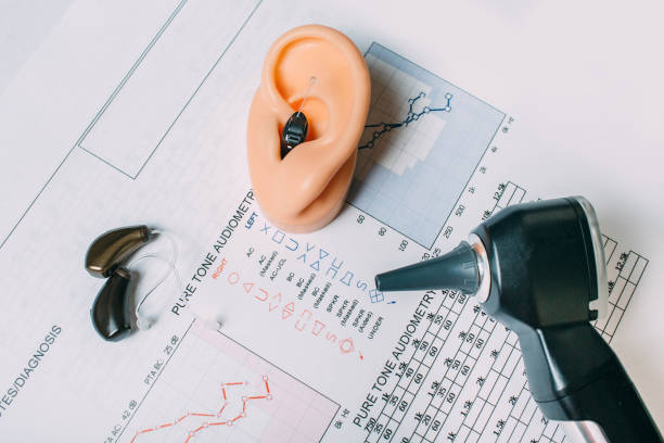 Hearing exam result - audiogram and hearing aids on the table Hearing test concept. Result of hearing exam - audiogram, hearing aids and otoscope on the table, view from above. audiologist stock pictures, royalty-free photos & images