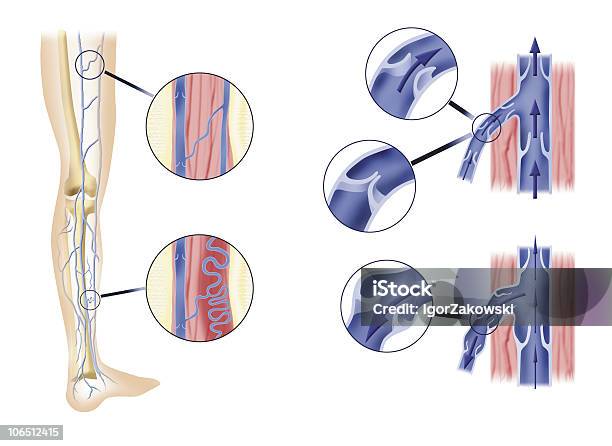 Artère Jambes Et Aortic Soupapes Vecteurs libres de droits et plus d'images vectorielles de Jambe humaine - Jambe humaine, Veine humaine, Aorte