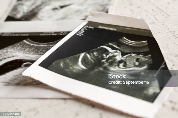 Photographs Of Ultrasound Of Pregnancy At 4 Weeks And 20 Weeks Of Pregnancy Selective Focus Stock Photo - Download Image Now