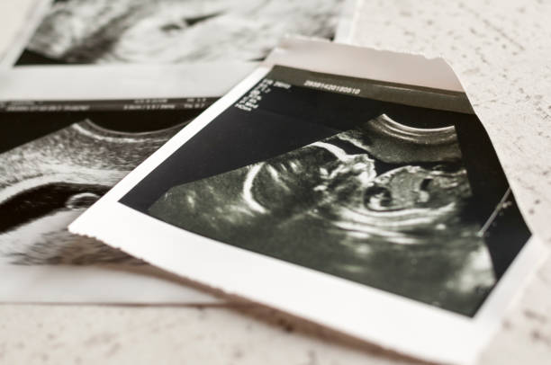 zdjęcia usg ciąży w 4 tygodniu i 20 tygodniu ciąży. selektywna ostrość - 1354 zdjęcia i obrazy z banku zdjęć